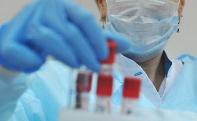 В Киеве от коронавируса умер 35-летний мужчина