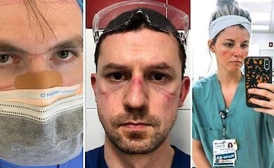 Многие медики будут нуждаться в лечении от посттравматического стрессового расстройства