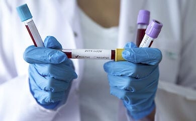 Тесты на коронавирус стали проводить в три раза чаще - МОЗ