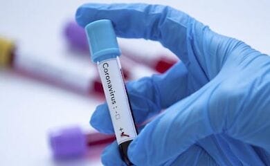 У Києві від коронавирусу помер 31-річний чоловік