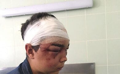 Парень рассказал, что отпустили его только с тем условием, что он никому ничего не расскажет