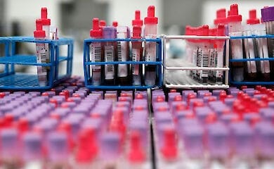 В Киеве - вспышка коронавируса: в интернате для девочек 81 заболевший