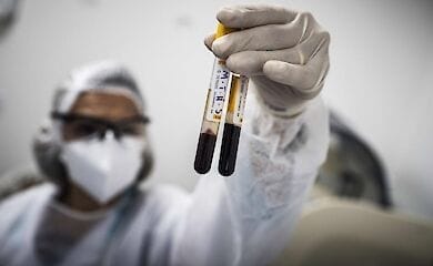В Бразилии разработан первый в мире генетический тест на коронавирус