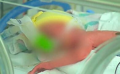 Перший випадок зараження був виявлений 18 травня