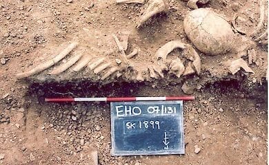 В захоронениях древних викингов нашли вирус натуральная оспа, отличающийся от современного.