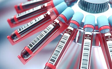 МОЗ хоче відновити виготовлення вітчизняних вакцин