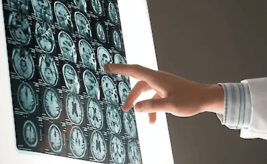 Житель Великобританії протягом трьох років прикидався хворим на рак