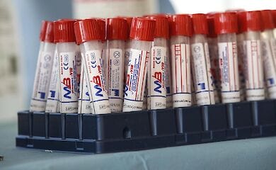 Експерти не змогли з'ясувати, що породило коронавірус