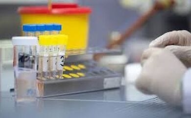 В Україні добовий приріст пацієнтів з Covid-19 може збільшитися вдвічі - лікар