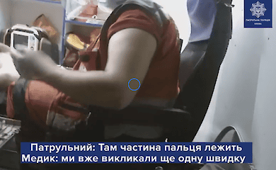 Полиция задержала киевлянина, который откусил отцу палец и разбил собакой окно
