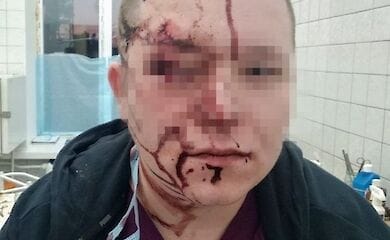 В Киеве пациент избил врача