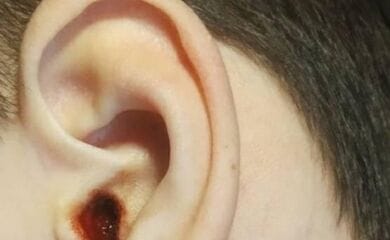 Врач на медосмотре расковырял ребенку ухо до кровавой жижи