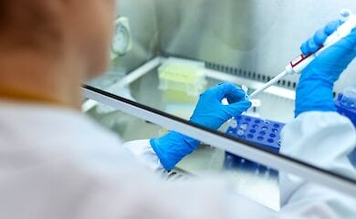 В Украине в 2020 году количество выявленных случаев туберкулеза сократилось на 30%