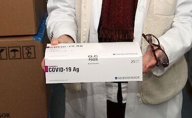Люди з ВІЛ і туберкульозом зможуть зробити тест на COVID-19 безкоштовно
