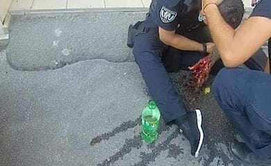 Стало известно о состоянии патрульного, которого ранили в Киеве.