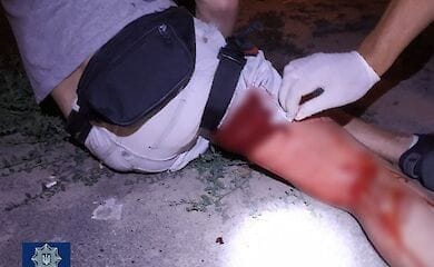 В Киеве на прохожего напал мужчина с ножом