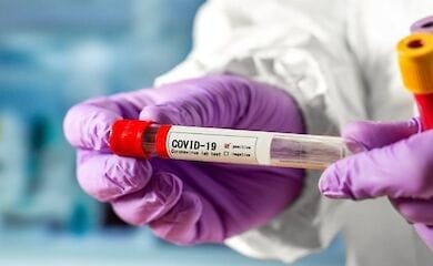 Вчені навчилися по слині визначати тяжкість форми коронавирусу