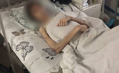 В Одессе отец довел 16-летнего сына до истощения