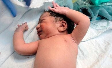 Девочка с эмбрионом близнеца в желудке родилась в Израиле