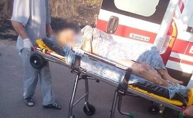 Пенсионерка хотела сжечь мусор и подожгла себя