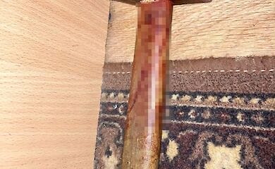 У Києві на Оболоні пенсіонер бив дружину молотком по голові