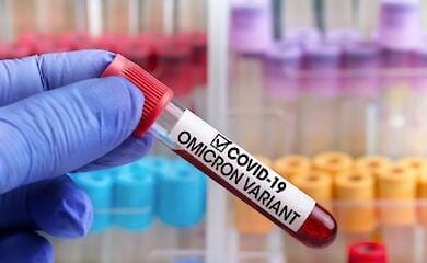 Врачи рассказали, когда появляются симптомы при заражении Омикроном