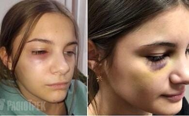 У рівно семикласник жорстоко побив школярку