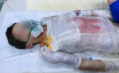 Трагедия на Кировоградщине: школьник вылил на себя бензин и поджег спички