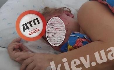У Києві жорстоко побили двох літніх жінок (фото 18+)