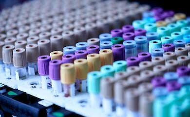 В мире зафиксировали 920 случаев острого гепатита неизвестной этиологии у детей