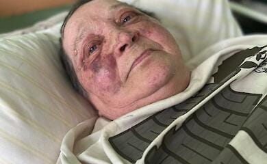 70-летней журналистке из Херсона оккупанты сломали позвоночник