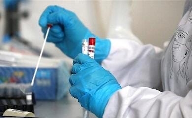 Вчені створили новий штам коронавірусу з 80% смертністю