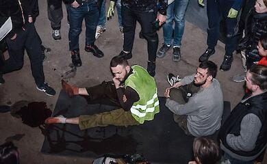 посольство РФ у Лондоні звинуватило Україну у створенні фейкових фото поранених мирних жителів