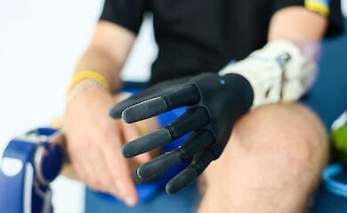 Українці можуть отримати протез безкоштовно
