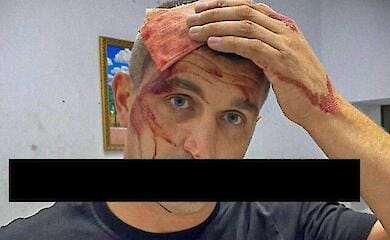 У Маріуполі вдарили ломом по голові російського політика й активіста 