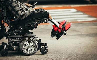 Хто в Україні може претендувати на безкоштовне протезування 