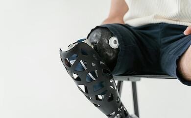 Отримати високофункціональні протези можна буде швидше - Мінсоцполітики