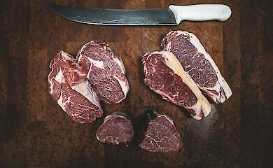 Житель США підхопив сибірську виразку після вечері