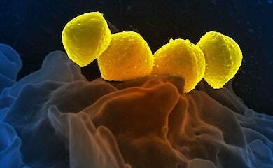 В Японії поширюється нова смертоносна бактерія