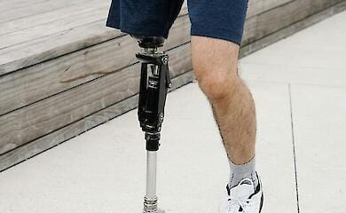 МОЗ планує запустити електронну чергу для отримання ендопротезів