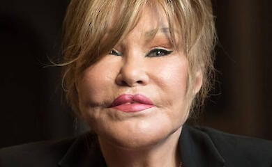Умерла “женщина-кошка”, известная поклонница пластической хирургии
