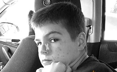 У Києві помер 12-річний хлопчик, який постраждав від удару струмом на електричці
