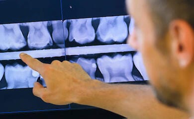 Как состояние ротовой полости влияет на мигрень у женщин