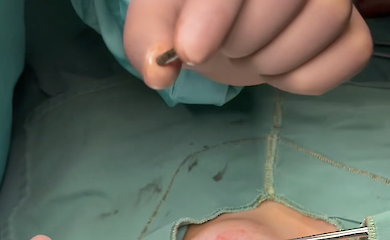 Тодуров показав кулю, яку витягли із серця колишнього військовополоненого