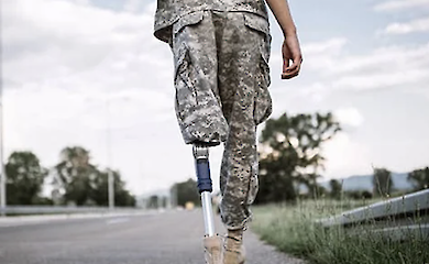 Як зміниться система протезування, розповіли в уряді