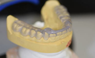 Элайнеры в Украине: всё, что нужно знать перед началом лечения