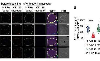 Учёные нашли причину неэффективности иммунотерапии при некоторых видах рака