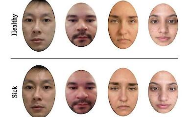 Розпізнати хворобу за обличчям: жінки справляються краще за чоловіків