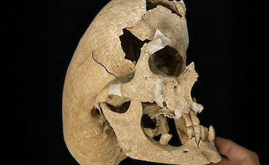 Археологи знайшли лицаря з важкою деформацією черепа - і з'ясували, як він жив і загинув