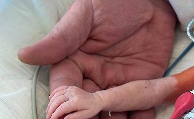 Крихітне немовля з важкою вадою серця прооперували в Києві